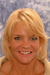 before-porcelain-veneers
