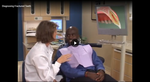 Diagnosing Fractured Teeth