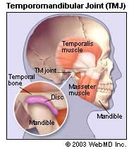 TMJ Causes