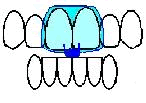 TMJ Treatment