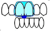 TMJ Treatments