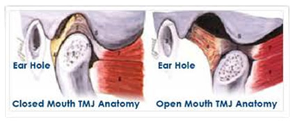 Shelby Township Dentist Discusses Jaw Pain 