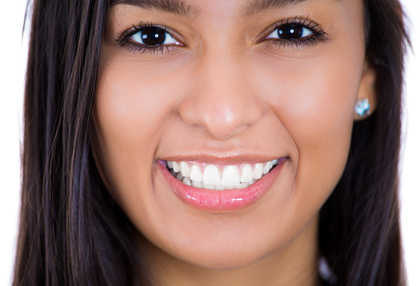 Closeup headshot young beautiful smiling happy woman What is the Cost of Dental Veneers