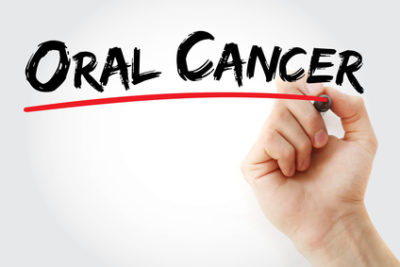 Oral Cancer: What You Need to Know Oral Cancer: What You Need to Know